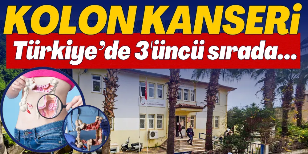 KOLON KANSERİ 3’ÜNCÜ SIRADA